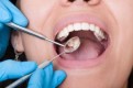 Best Dental Clinic in Abu Dhabi- Bella Medical Centre