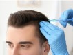 best hair specialist abudhabi | PRP treatment in abudhabi | PRP clinic