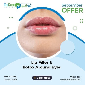 Lip Fillers Dubai