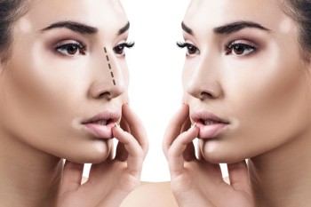 Nose Augmentation Dubai