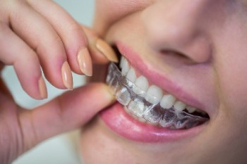 Invisible Braces and Dental Treatment Centre in Dubai