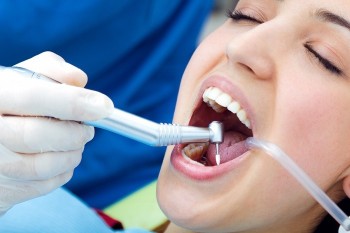 Dental Implant Clinic in Dubai