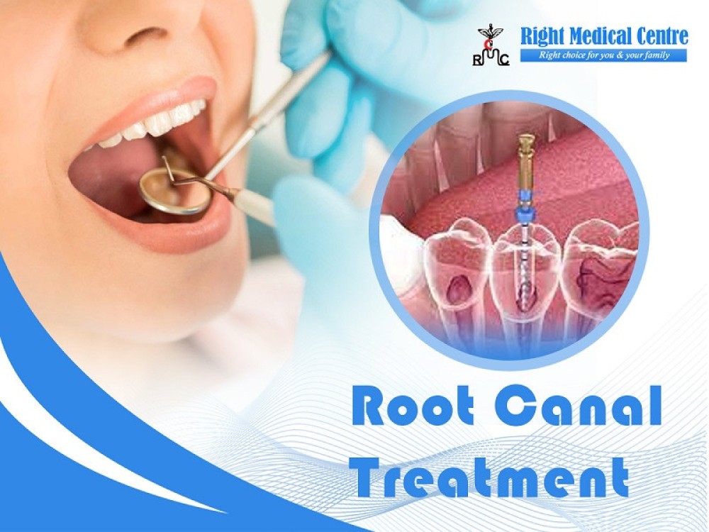 Tooth Filling - Root Canal Treatment in Sharjah, Abu Shagara