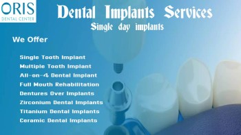 dental implants