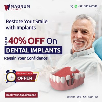 Magnum Dental Clinic - Dental Implant in Dubai