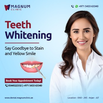 Magnum Dental Clinic - Teeth Whitening in Dubai