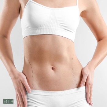 Abdominoplasty in Dubai - Ecla Clinic