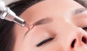 Carbon Laser Facial Resurfacing in Jeddah