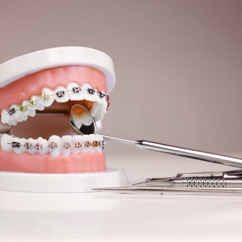 Best orthodontist in Dubai