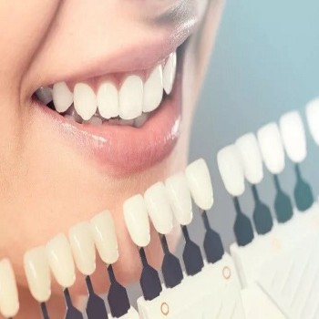 Best Cosmetic dentistry treatment in Dubai UAE