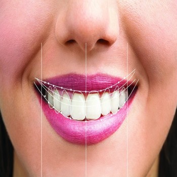 Best Smile designing treatment in Dubai UAE