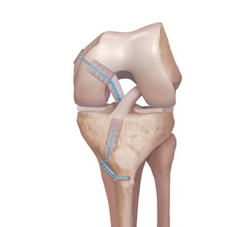 Knee Doctor In Dubai | Dr Rik Kundra