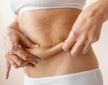 body sculpting Dubai | Dr Juan Carlos