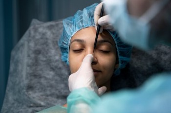 Rhinoplasty Swelling Stages | Expectation After Rhinoplasty