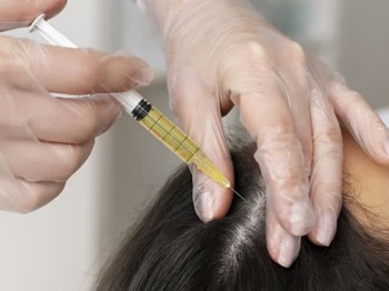 PRP in Sharjah | Dr Mahesh Kumar